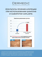 Набор средств, стимулирующих рост волос «Hair Growth Stimulation» - Фото 3