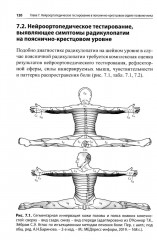 Нейроортопедическое тестирование в практике малоинвазивной терапии - Фото 7