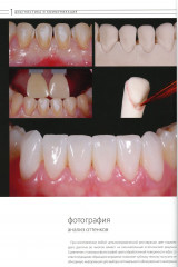 Эстетическая и реставрационная стоматология. Выбор материалов и методов - Фото 9