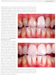 Эстетическая и реставрационная стоматология. Выбор материалов и методов - Фото 10