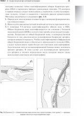 Справочник по интервенционным радиологическим процедурам - Фото 1