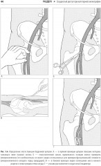 Справочник по интервенционным радиологическим процедурам - Фото 3