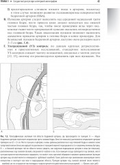 Справочник по интервенционным радиологическим процедурам - Фото 4