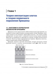 Диагностика и хирургическое лечение перитонеального канцероматоза - Фото 3