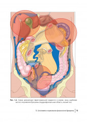 Диагностика и хирургическое лечение перитонеального канцероматоза - Фото 7