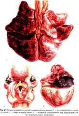 Судебно-медицинская экспертиза при радиационных поражениях - Фото 11