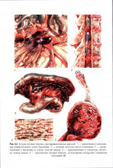 Судебно-медицинская экспертиза при радиационных поражениях - Фото 12