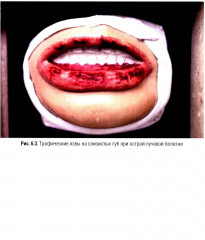Судебно-медицинская экспертиза при радиационных поражениях - Фото 13