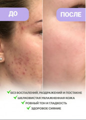 Крем для лица с ресвератролом восстанавливающий «Resveratrol 345 NA Intensive Repair Cream» - Фото 1