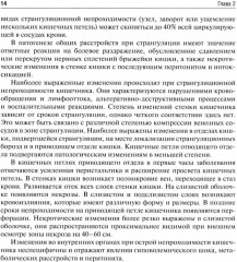 Кишечная непроходимость - Фото 6