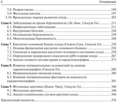 Кардиотокография. Мониторинг состояния плода. Практическое руководство - Фото 2