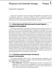 Кардиотокография. Мониторинг состояния плода. Практическое руководство - Фото 6