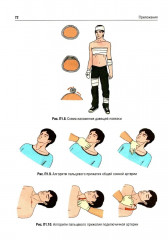 Охрана труда. Оказание первой помощи при жизнеугрожающих состояниях - Фото 9