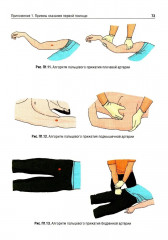 Охрана труда. Оказание первой помощи при жизнеугрожающих состояниях - Фото 10