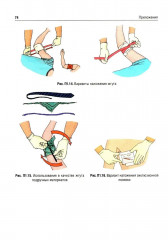 Охрана труда. Оказание первой помощи при жизнеугрожающих состояниях - Фото 11