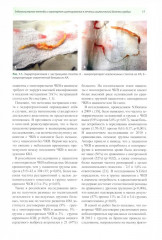 Актуальные частные вопросы коронарной хирургии - Фото 11