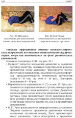 Прикладная физиология мышечной активности в контексте профилактики, лечения и реабилитации - Фото 11