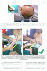 Неотложные состояния и травмы в акушерстве. Быстрая диагностика и лечение - Фото 9