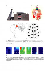 Хронические нарушения сознания: нейрореабилитация - Фото 12