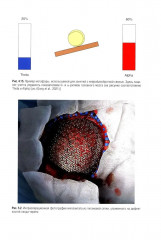 Хронические нарушения сознания: нейрореабилитация - Фото 13