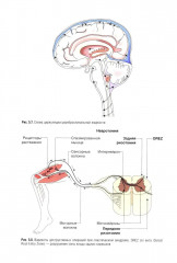 Хронические нарушения сознания: нейрореабилитация - Фото 14