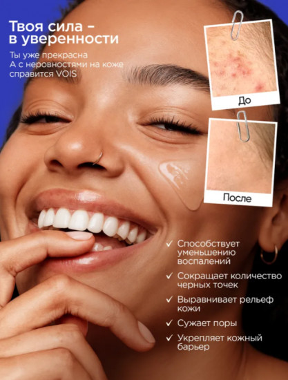 Сыворотка для лица с ниацинамидом для проблемной и комбинированной кожи