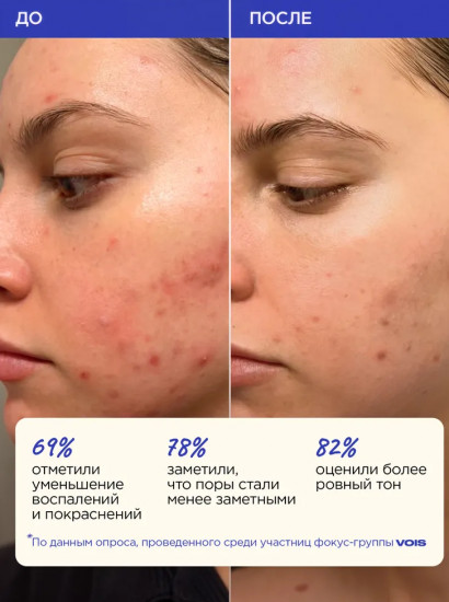 Cыворотка для лица с ниацинамидом и салициловой кислотой