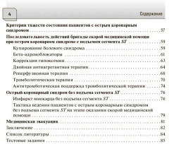 Острый коронарный синдром. Диагностика и неотложная помощь - Фото 2