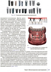 Ортопедическая стоматология. Руководство для врачей - Фото 6