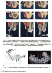 Ортопедическая стоматология. Руководство для врачей - Фото 7