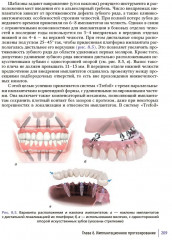 Ортопедическая стоматология. Руководство для врачей - Фото 8