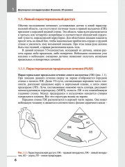 Эхокардиография. Методика и количественная оценка - Фото 3