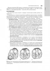 Акушерство - Фото 11