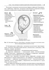 Инфекции в период беременности - Фото 3
