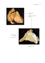 Кардиохирургия. Техника выполнения операций - Фото 5