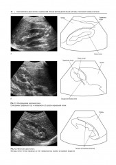 Практическая ультразвуковая диагностика. Том 2. Ультразвуковая диагностика заболеваний органов мочевыделительной системы и мужских половых органов - Фото 5