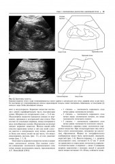 Практическая ультразвуковая диагностика. Том 2. Ультразвуковая диагностика заболеваний органов мочевыделительной системы и мужских половых органов - Фото 6