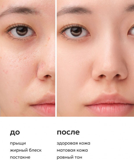 Себорегулирующий крем для лица с ниацинамидом и цинком