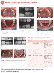 Детская стоматология. Руководство - Фото 2