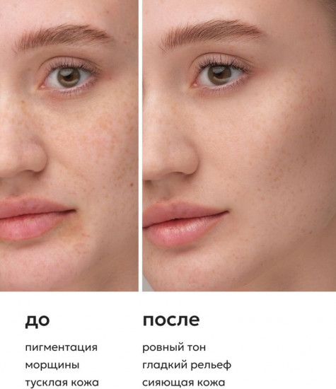 Сыворотка для лица с витамином С