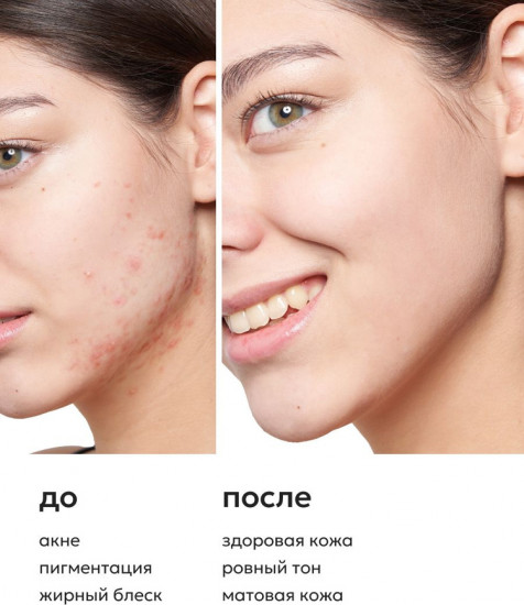 Сыворотка для лица с ниацинамидом и цинком