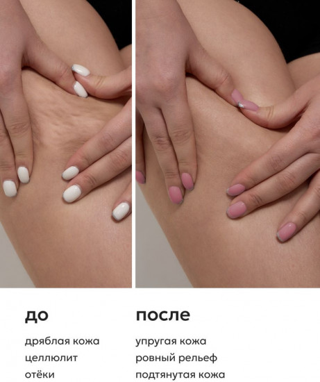 Крио-сыворотка для тела «Crio serum»