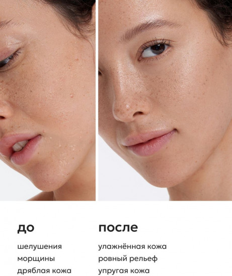 Тоник для лица с гиалуроновой кислотой