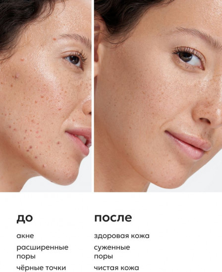 Тоник для лица с фруктовыми кислотами