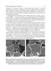 Одонтогенный верхнечелюстной синусит - Фото 5