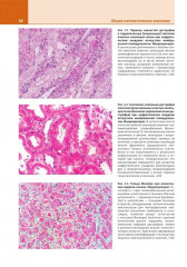 Патологическая анатомия. Атлас. Том 1. Общая патологическая анатомия - Фото 5