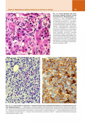 Патологическая анатомия. Атлас. Том 1. Общая патологическая анатомия - Фото 6
