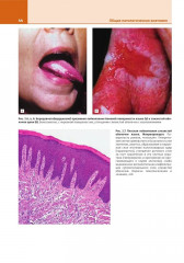 Патологическая анатомия. Атлас. Том 1. Общая патологическая анатомия - Фото 7