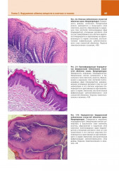 Патологическая анатомия. Атлас. Том 1. Общая патологическая анатомия - Фото 8
