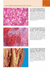 Патологическая анатомия. Атлас. Том 1. Общая патологическая анатомия - Фото 9